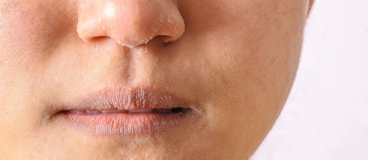 Deep hydration skincare for dry skin at Elume Medspa