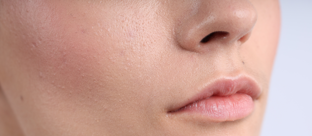 Skincare products for normal skin at Elume Medspa